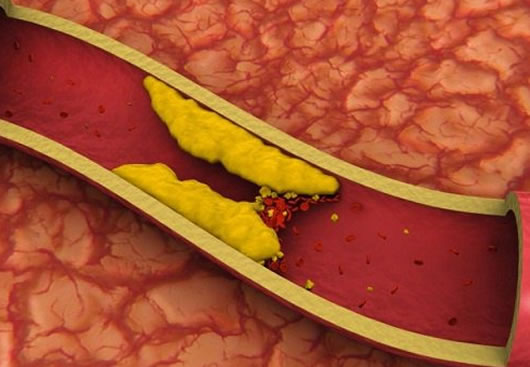 Serrano Schinken und Cholesterin